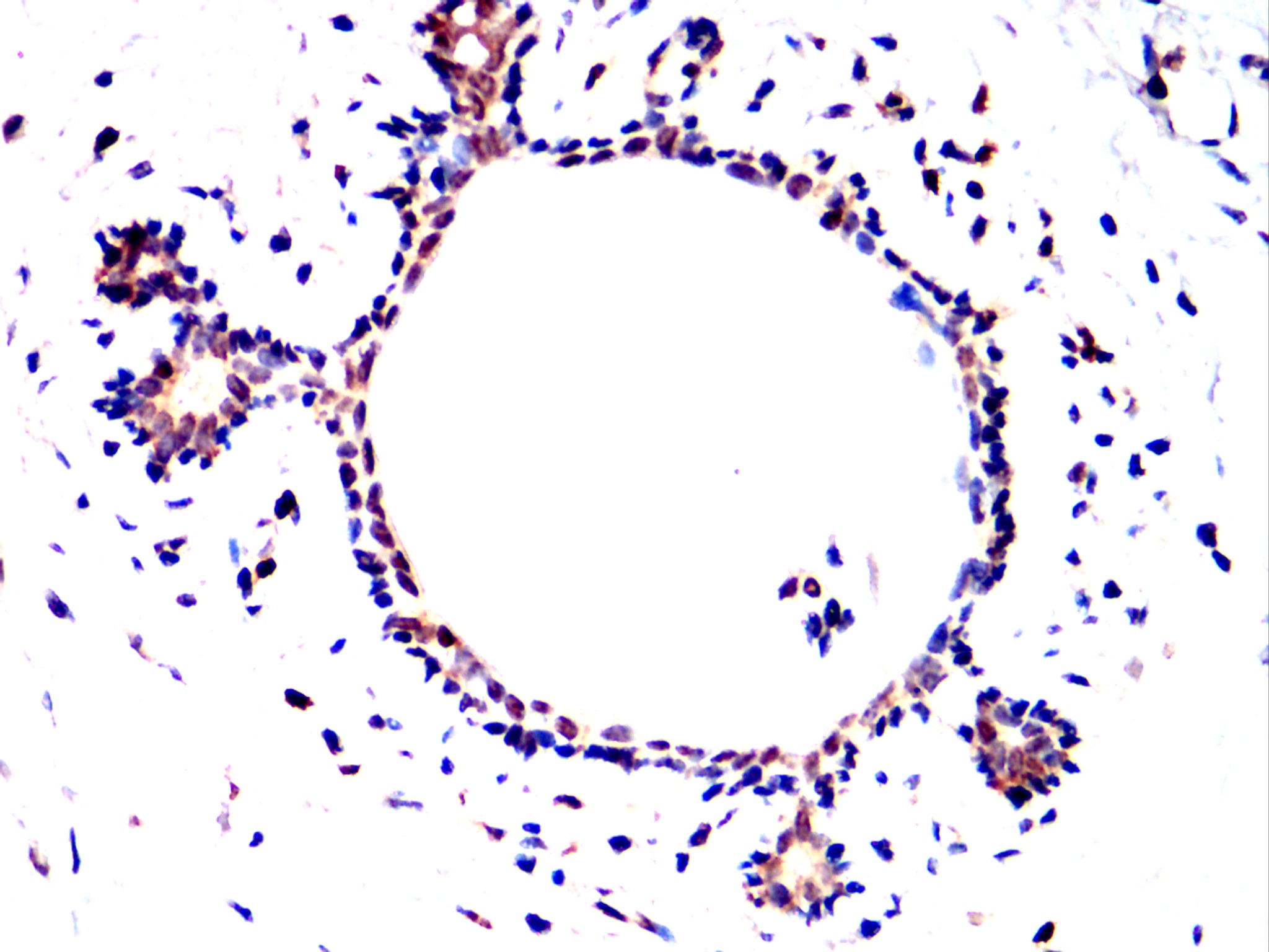 IHC